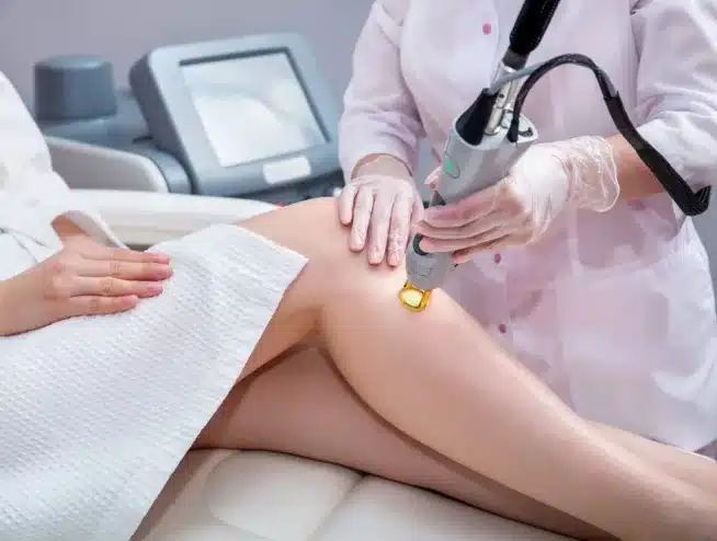 How Many Sessions Do You Need for Laser Hair Removal?