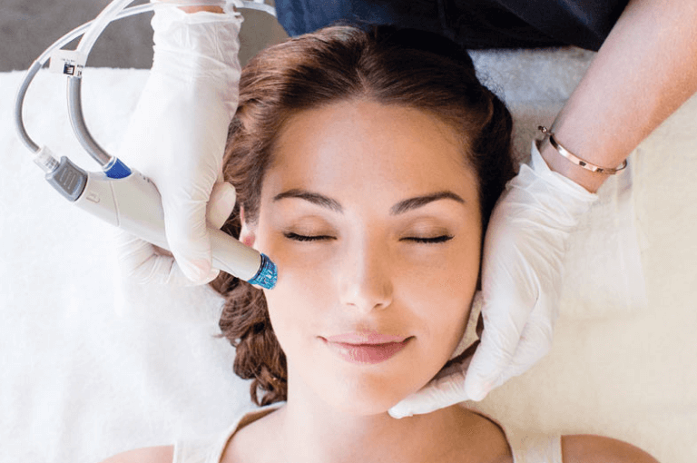 Laser Treatment for Acne Scars in Brooklyn, NY