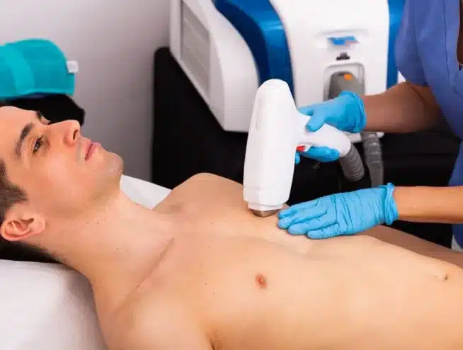 Laser Hair Removal For Men Preparing For Your Treatment